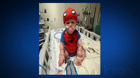 1st Texas pediatric partial heart transplant performed in Austin